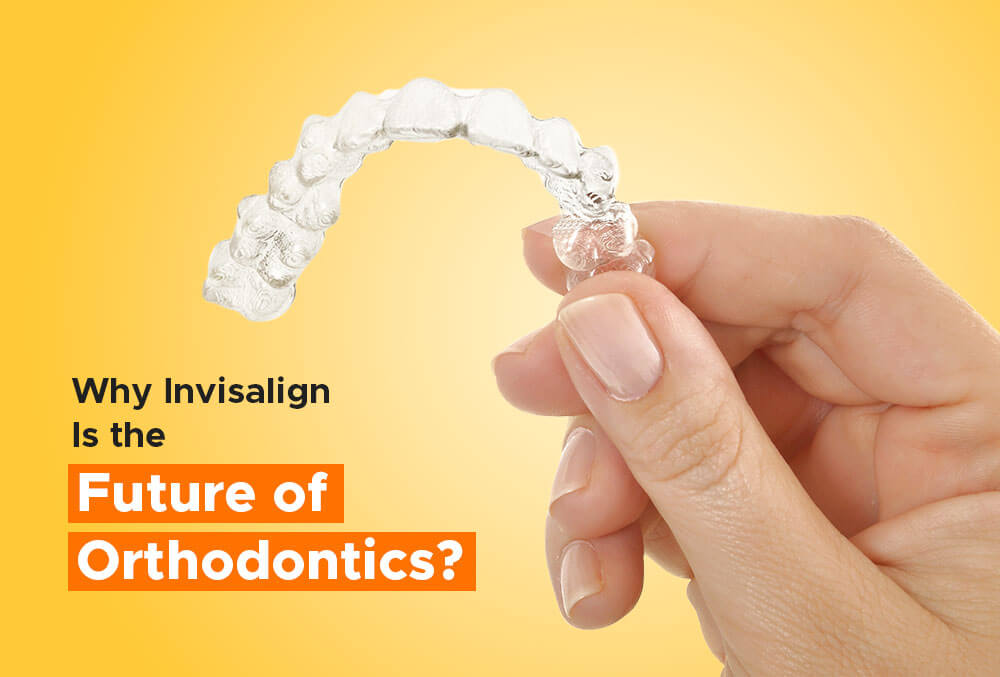 why invisalign is the future of orthodontics