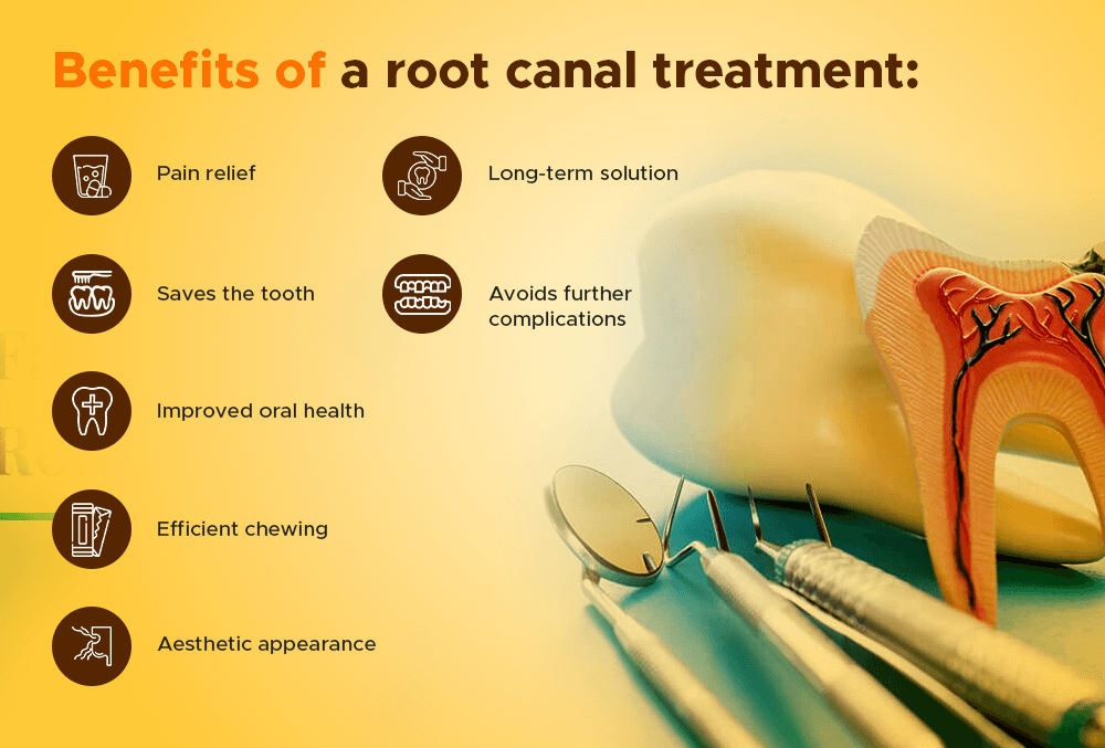 benefits of a root canal treatment