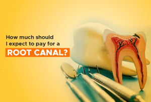 how much should i expect to pay for a root canal
