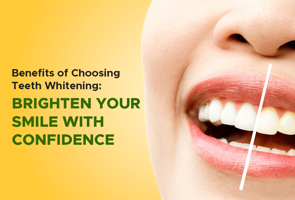 benefits of choosing teeth whitening