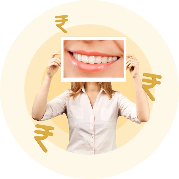 Root Canal Treatment Illustration