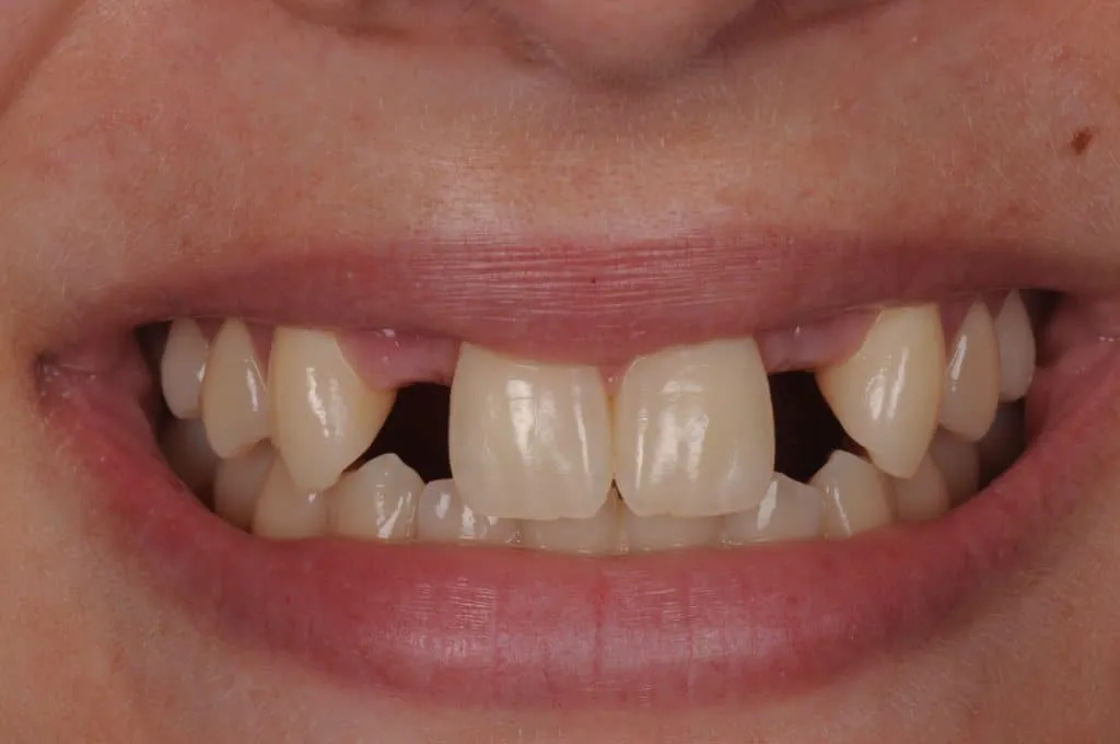 Before Image