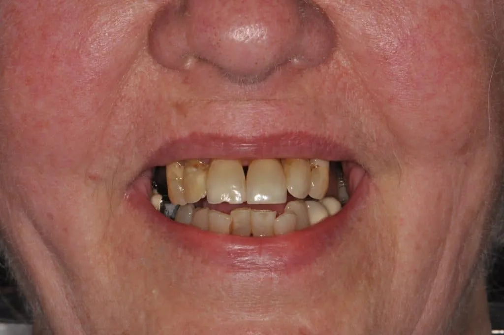 Before Image