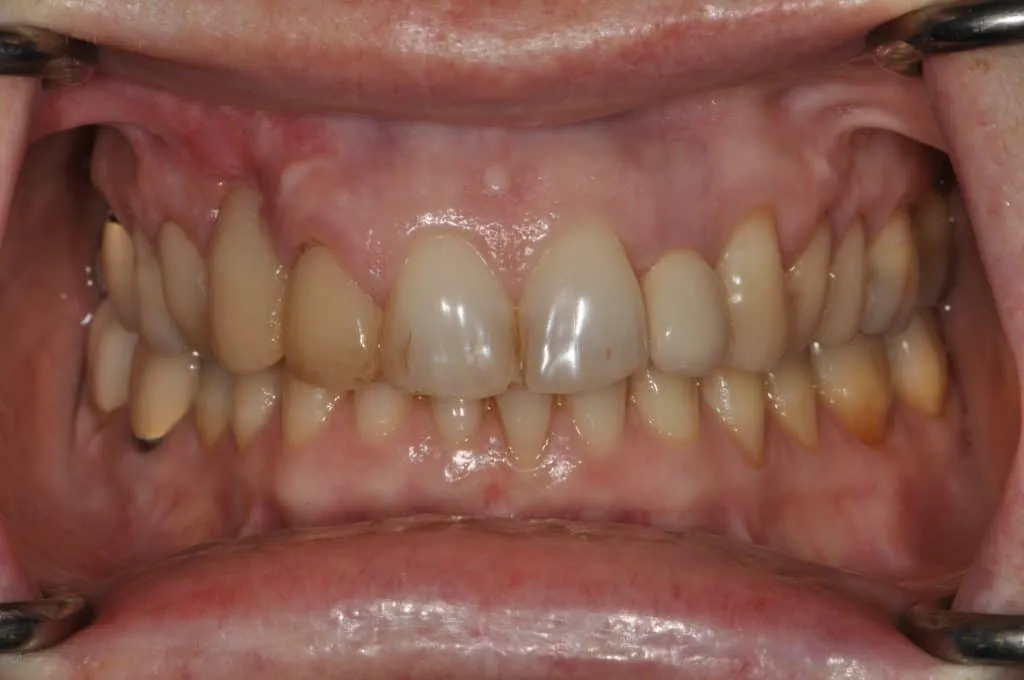 Before Image