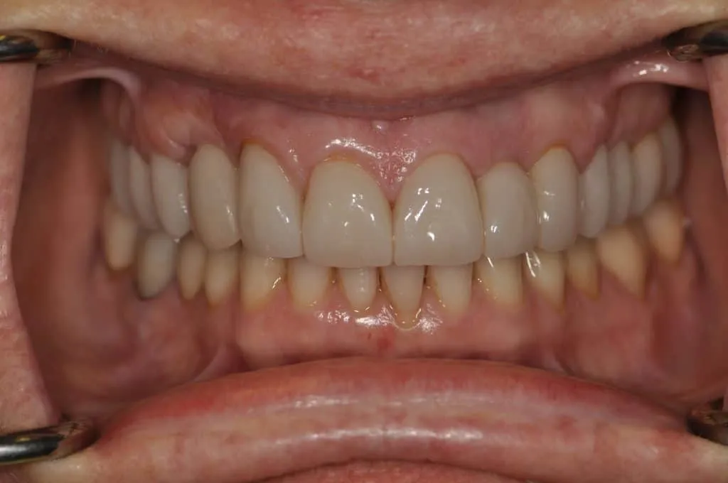 After Image
