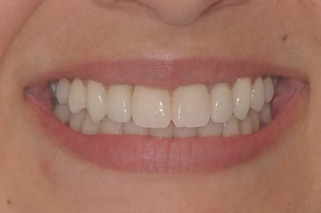 After Image