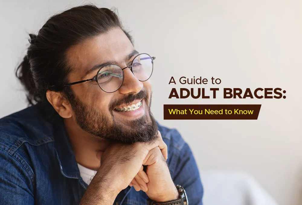 A Guide to Adult Braces: What You Need to Know