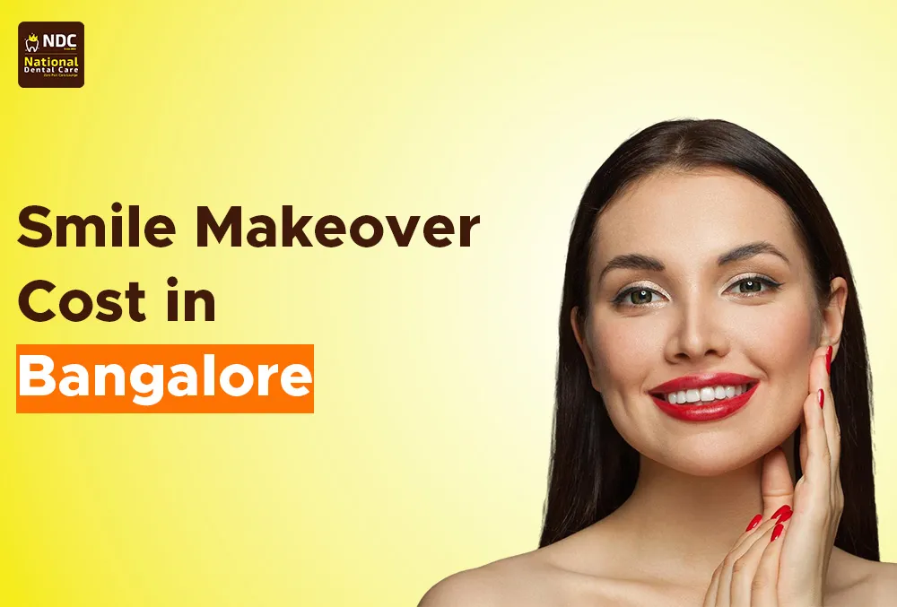Smile Makeover