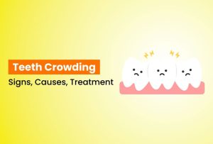 teeth crowding