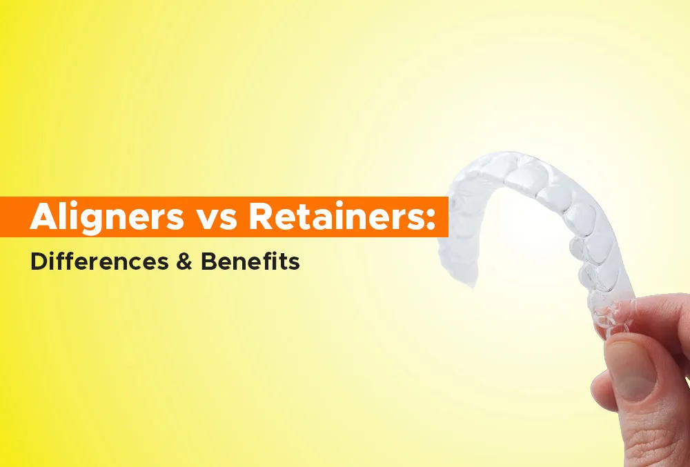 Aligners vs Retainers: Differences & Benefits
