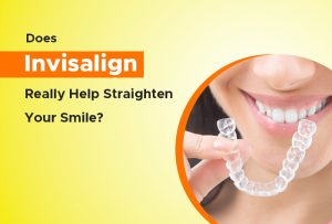 does invisalign really help straighten your smile?