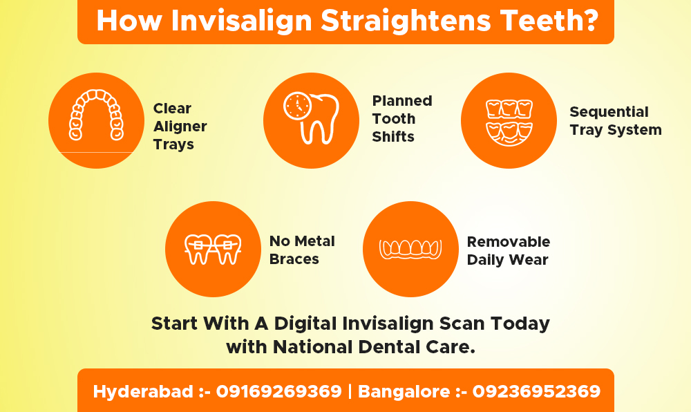 how invisalign straightens teeth?